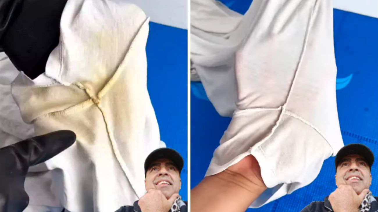 macchie gialle sotto le ascelle