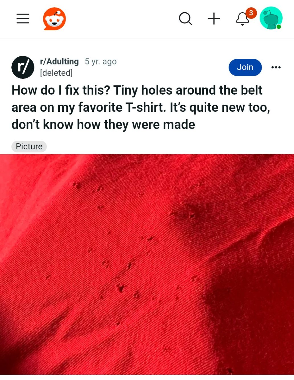 Il post Reddit che ha aperto la discussione su cosa causi quei piccoli buchi sulle t-shirt.