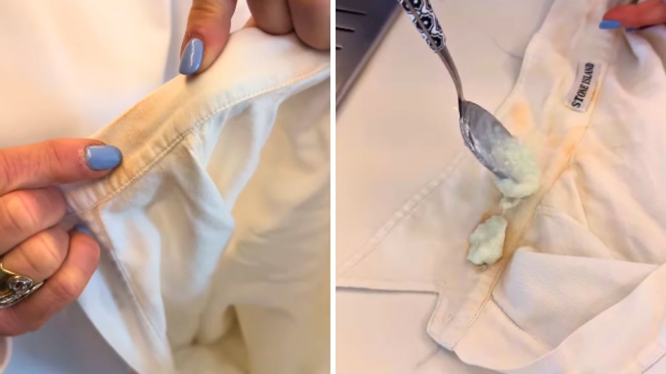 colletto della camicia