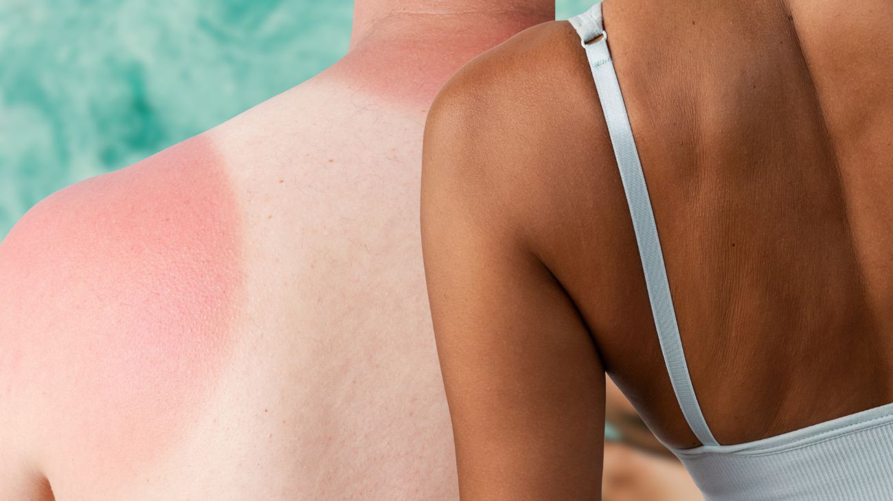 differenza colori pelle