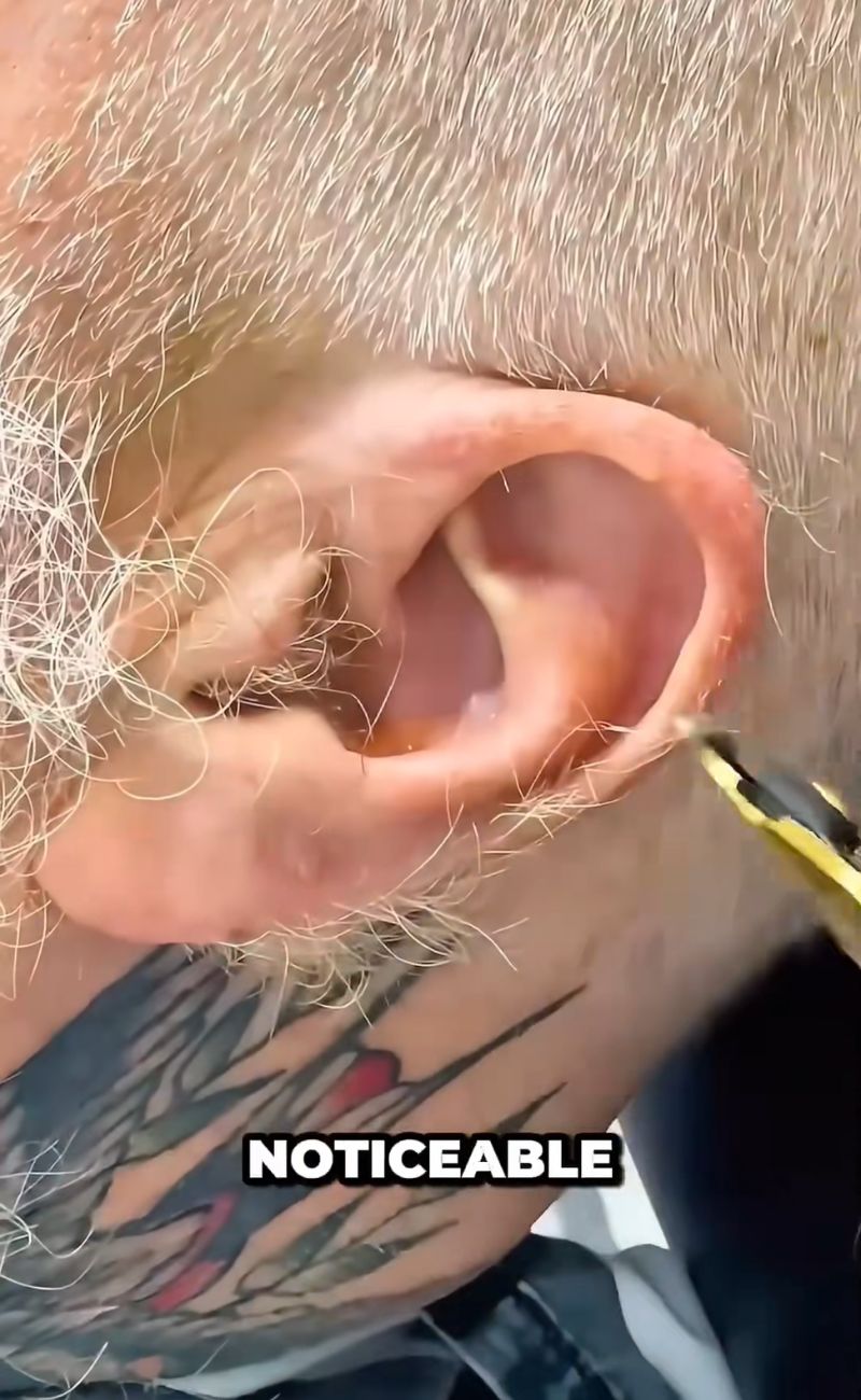 Non solo le sopracciglia: molti uomini, dopo i 60 anni, vedono crescere più pronunciati anche i peli attorno le orecchie