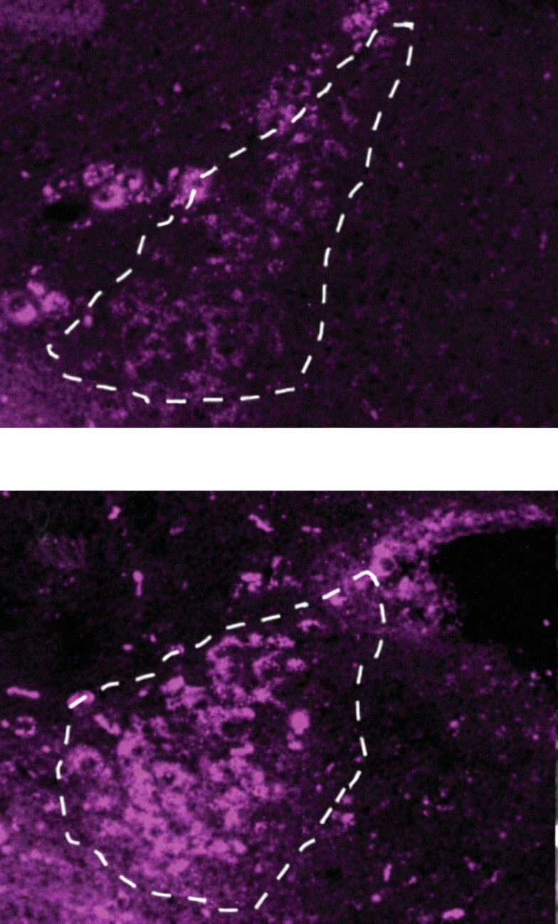 Alcol Cervello Giovani