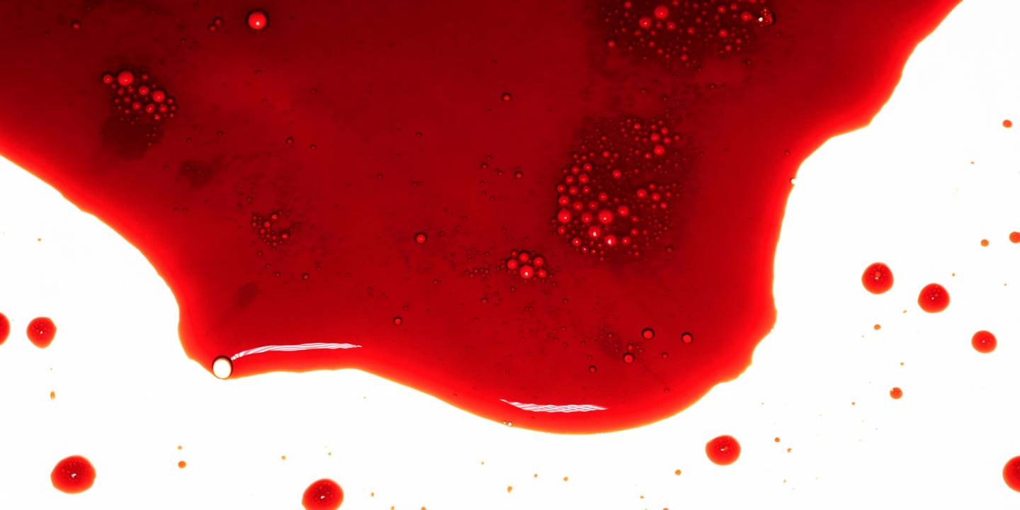 Gruppo Sanguigno Raro