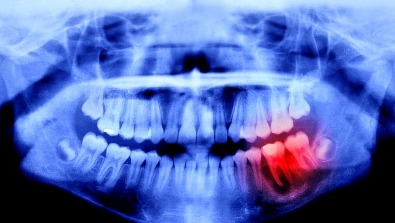Rigenerazione Denti