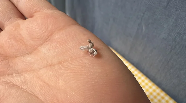Puntini bianchi che saltano sulle foglie: è la metcalfa, ecco come riconoscerla e fermarla senza veleni