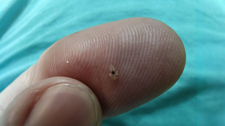 Hai trovato un pidocchio bianco sul collo? Le lenti sui capelli dicono da quanto è iniziata