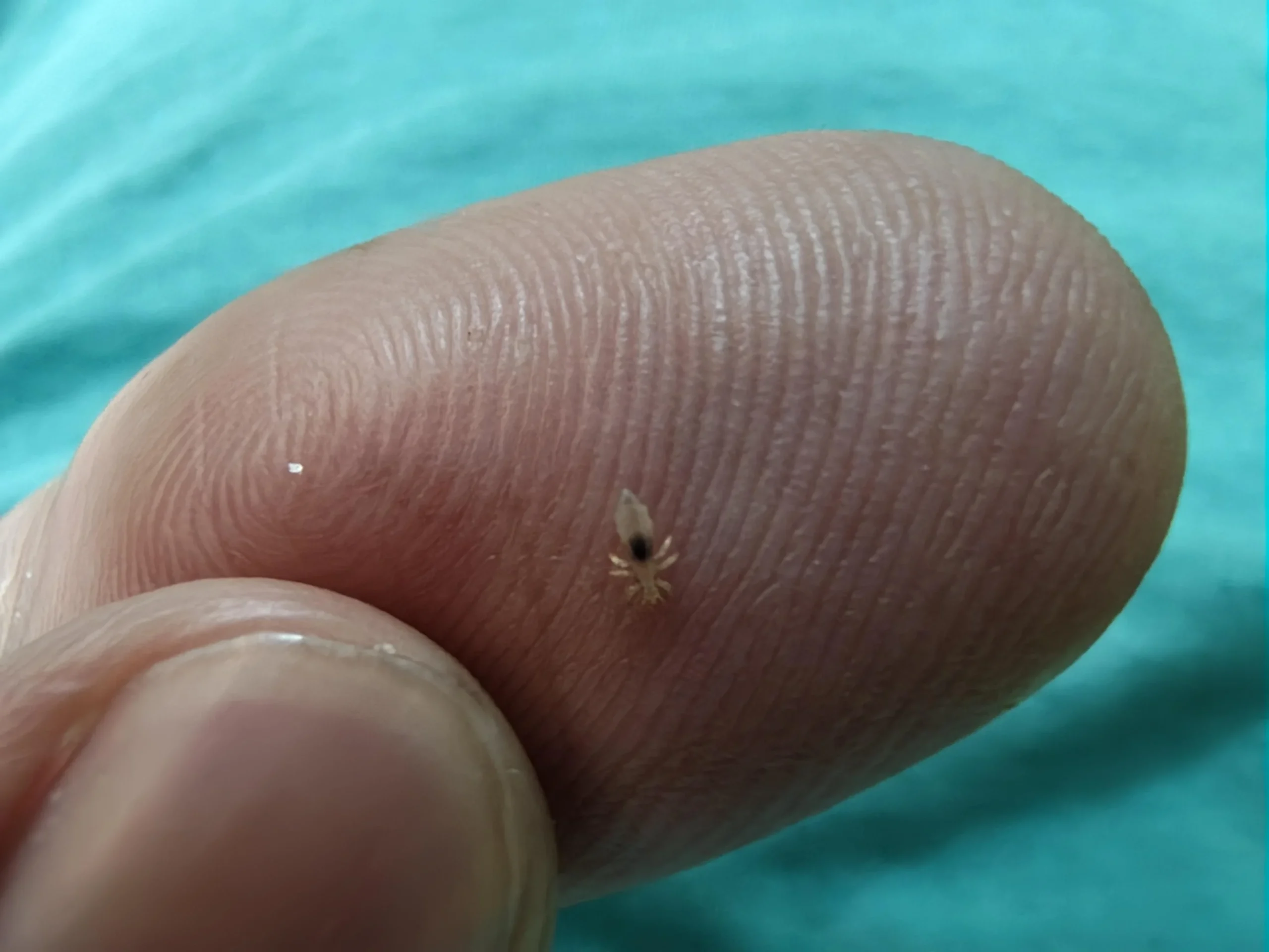 Hai trovato un pidocchio bianco sul collo? Le lenti sui capelli dicono da quanto è iniziata