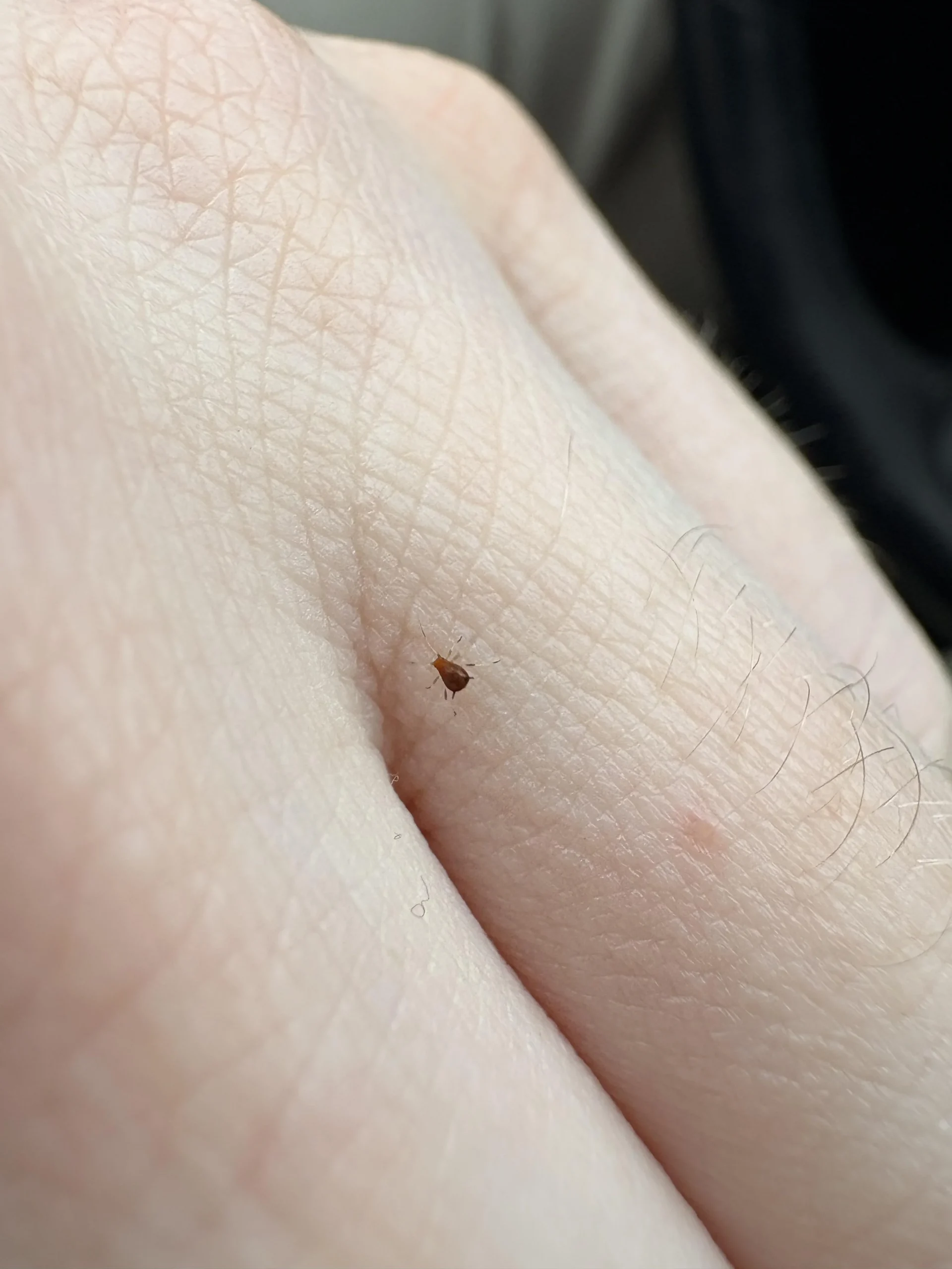 Zecca sulla pelle non attaccata: hai una finestra di tempo prima del morso, ecco come usarla